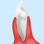 ［画像］健康な歯ぐき